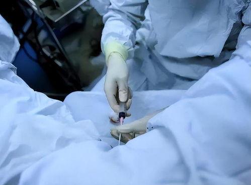 试管患者爆料案例视频,揭秘生育路上的心酸与希望  第3张